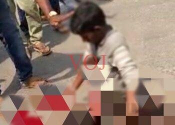 ಬೈಕ್ ಹಾಗೂ ಲಾರಿ ಮಧ್ಯೆ ಮುಖಾಮುಖಿ ಡಿಕ್ಕಿ ಬೈಕ್ ಸವಾರನ ಎರಡು ಕಾಲು ಕಟ್ !