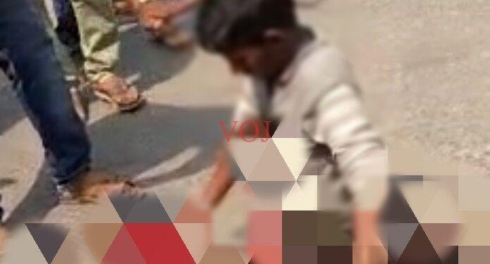 ಬೈಕ್ ಹಾಗೂ ಲಾರಿ ಮಧ್ಯೆ ಮುಖಾಮುಖಿ ಡಿಕ್ಕಿ ಬೈಕ್ ಸವಾರನ ಎರಡು ಕಾಲು ಕಟ್ !