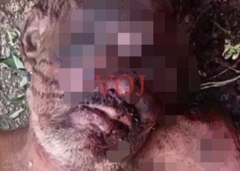 ಅಪರಿಚಿತ ವ್ಯಕ್ತಿಯ ಶವ ಪತ್ತೆ; ತನಿಖೆ ಚುರುಕುಗೊಳಿಸಿದ ಪೊಲೀಸರು: