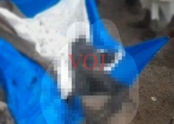 ಆಕಸ್ಮಿಕ ಬೆಂಕಿಗೆ ವ್ಯಕ್ತಿ ಬಲಿ;