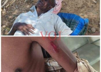 ಒಂಟಿ ಸಲಗ ದಾಳಿ; ಇರ್ವರ್ ರೈತರಿಗೆ ತೀವ್ರ ಗಾಯ..!