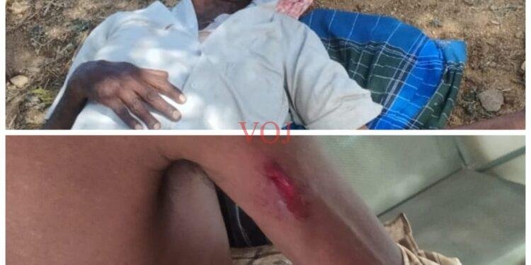 ಒಂಟಿ ಸಲಗ ದಾಳಿ; ಇರ್ವರ್ ರೈತರಿಗೆ ತೀವ್ರ ಗಾಯ..!