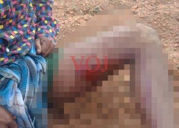 ಕರಡಿ ದಾಳಿ ವ್ಯಕ್ತಿಯೋರ್ವನಿಗೆ ಗಂಭೀರ ಗಾಯ..! ಆಗಿದ್ದು ಎಲ್ಲಿ..?