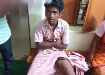 ಮಲೆ ಮಹದೇಶ್ವರ ಬೆಟ್ಟದ ಶಾಲಾ ವಿದ್ಯಾರ್ಥಿಯ ಮೇಲೆ ಹಂದಿ ದಾಳಿ..!