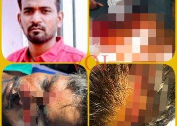 ಬ್ರೇಕಿಂಗ್ : ಮನೆಯ ಬಾಗಿಲು ಬಡಿದಿದ್ದಕ್ಕೆ, ಮಾರಣಾಂತಿಕ ಹಲ್ಲೆ..! ಎಲ್ಲಿ ಗೊತ್ತಾ..?