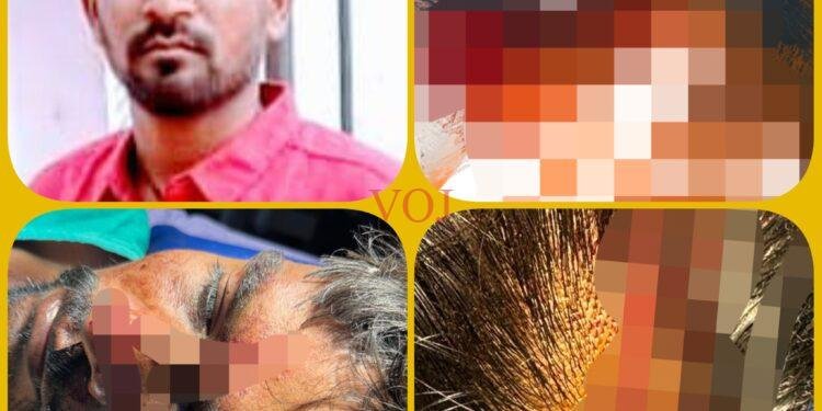 ಬ್ರೇಕಿಂಗ್ : ಮನೆಯ ಬಾಗಿಲು ಬಡಿದಿದ್ದಕ್ಕೆ, ಮಾರಣಾಂತಿಕ ಹಲ್ಲೆ..! ಎಲ್ಲಿ ಗೊತ್ತಾ..?