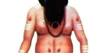 ಲಚ್ಯಾಣ ಶ್ರೀ ಸಿದ್ದಲಿಂಗೇಶ್ವರ ಕಮರಿ ಮಠದಲ್ಲಿ ಇಂದು ಲಕ್ಷ ಬಿಲ್ವಾರ್ಚನೆ ಮಹೋತ್ಸವ | ಸಹಸ್ರಾರು ಮುತ್ತೈದೆಯರಿಗೆ ಉಡಿ ತುಂಬುವ ಕಾರ್ಯಕ್ರಮ